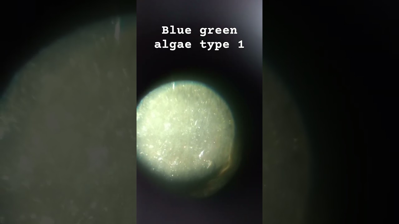 Watching blue green algae under microscope