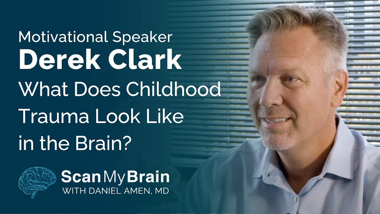 Motivational Speaker Derek Clark What Does Childhood Trauma Look Like in the Brain?
