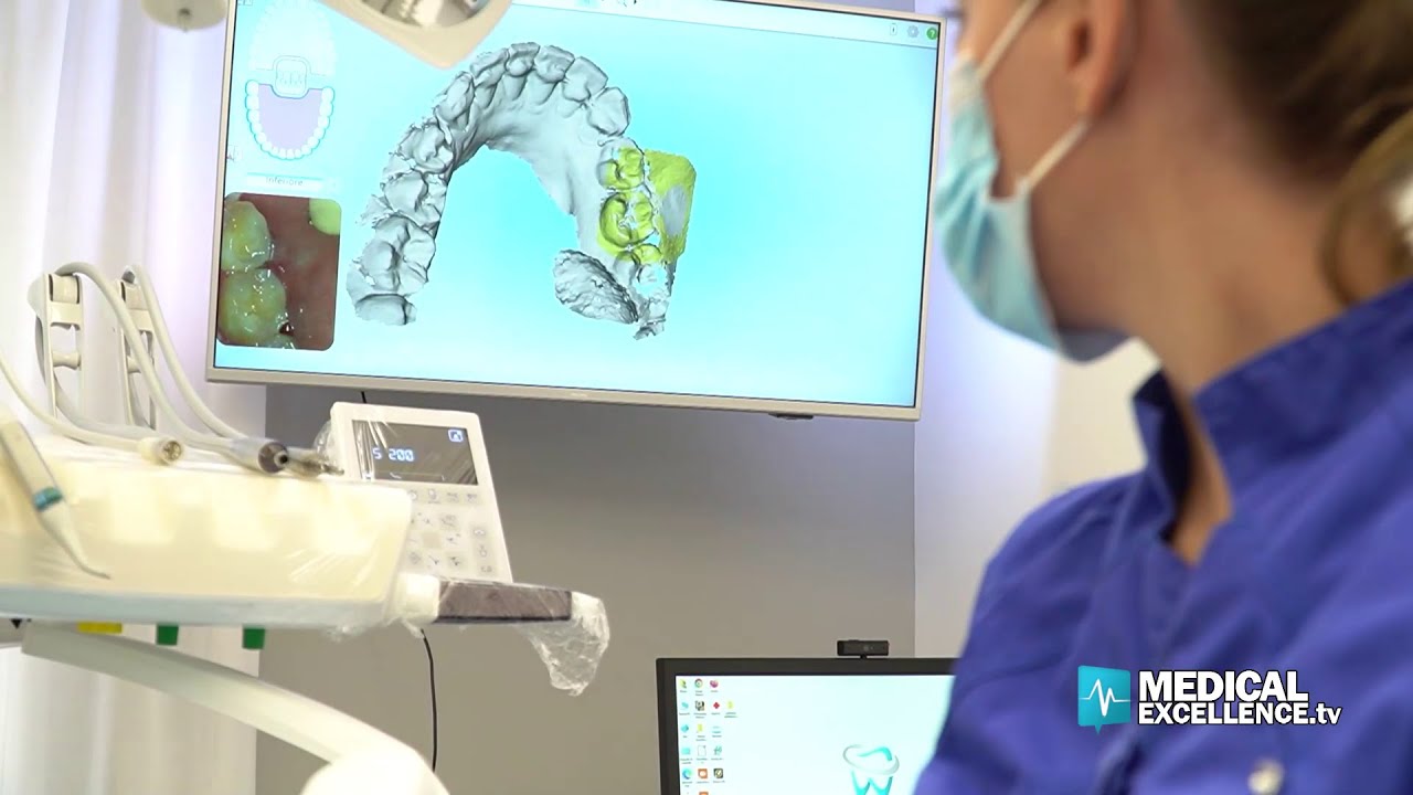 L’impronta digitale dei denti: modelli 3D delle arcate dentali