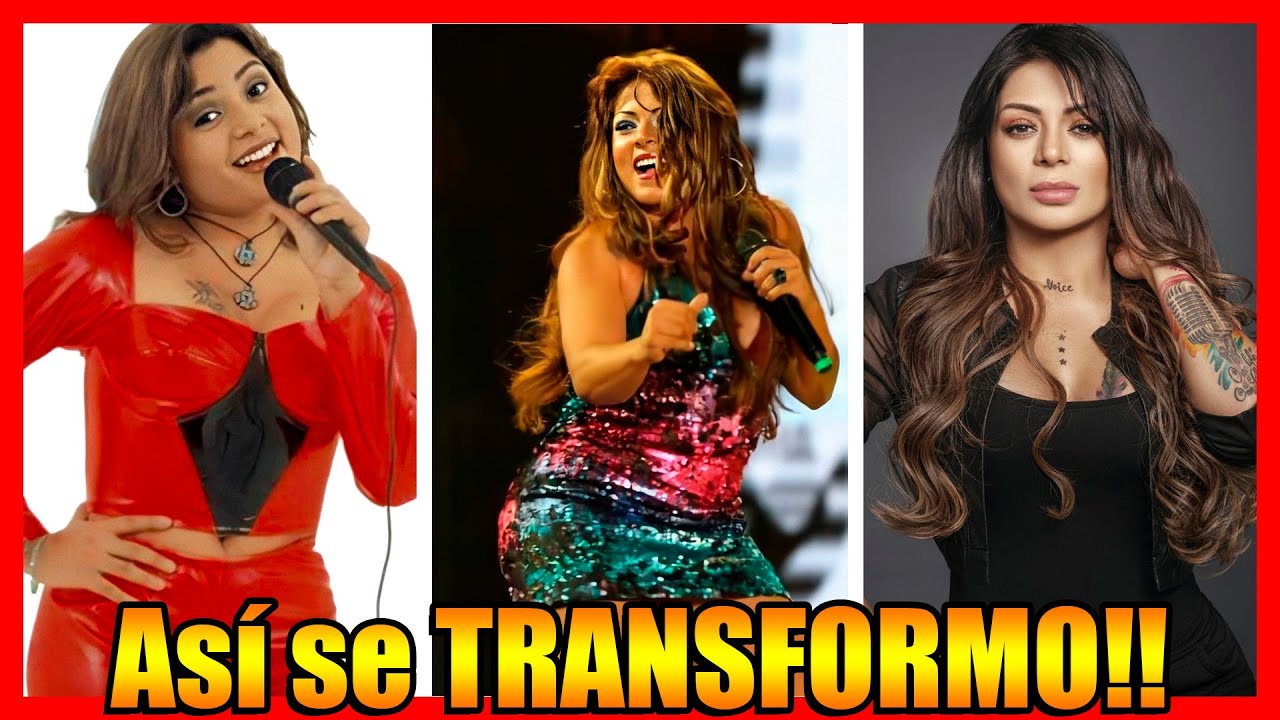 Antes y Despues de Marbelle y sus Cirugías 2021
