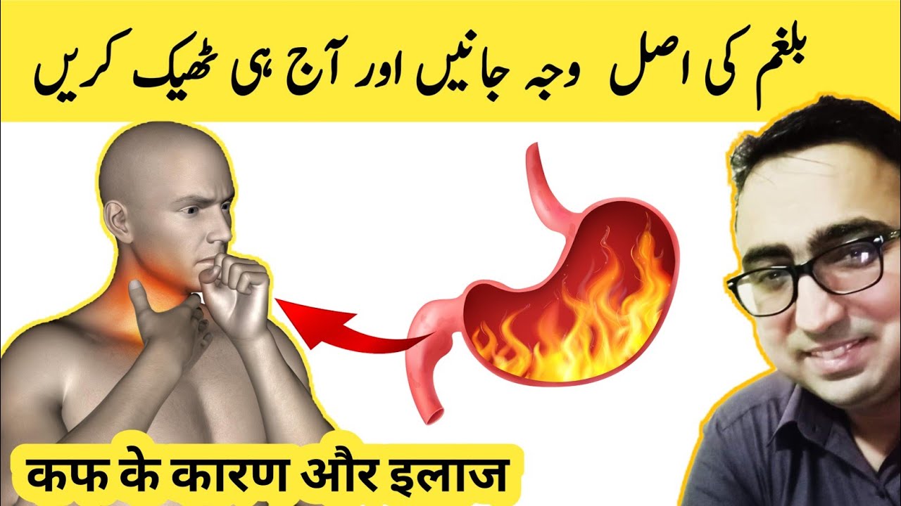 Top 3 Causes And Treatment Of Mucus And Phlegm - Dr Javaid Khan