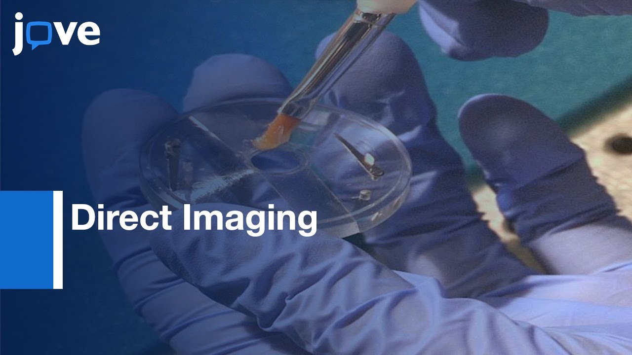 Direct Imaging: ER Calcium With Targeted-Esterase Induced Dye Loading (TED) l Protocol Preview