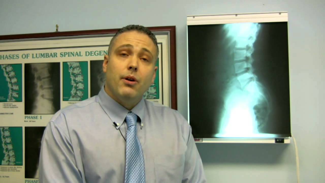 How to Tell if You Have a Broken Tailbone (Fractured Coccyx)