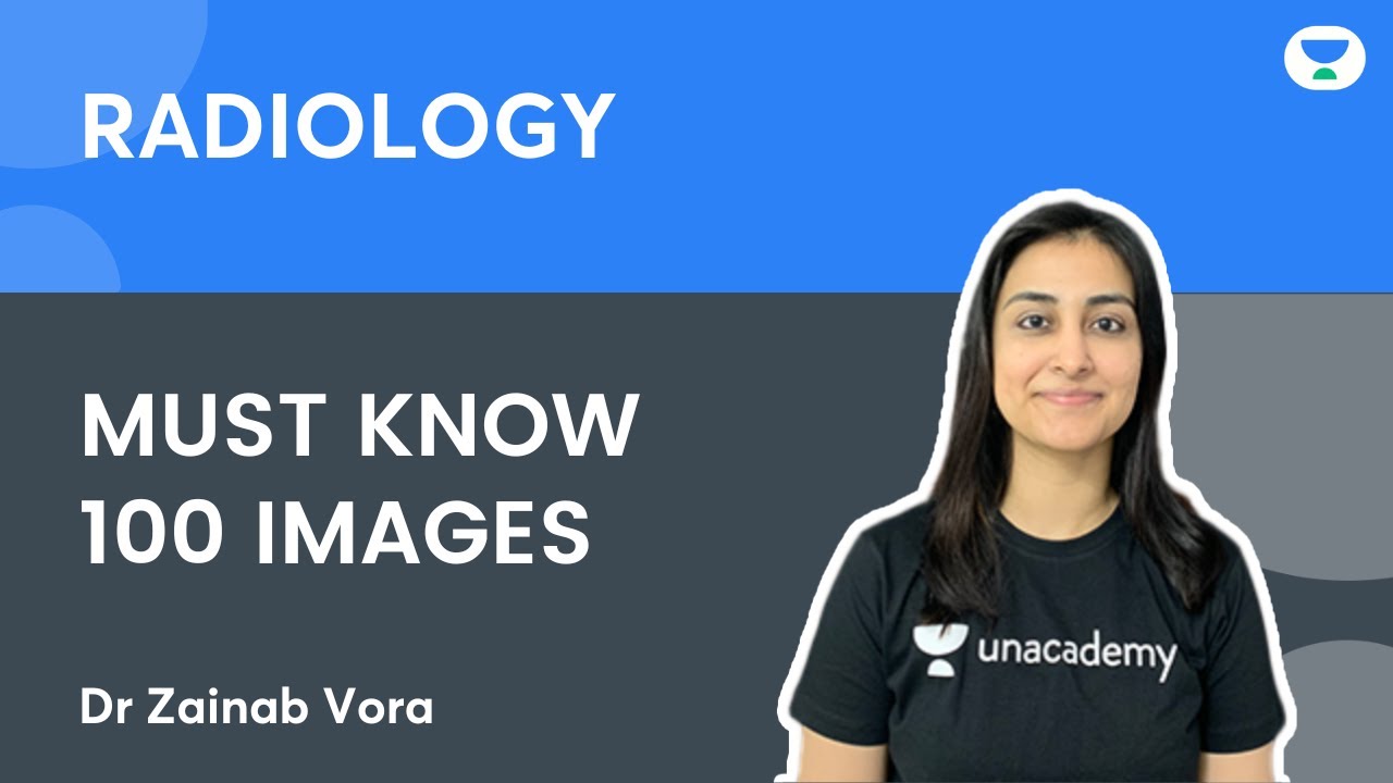 100 Radiology Images in order of importance - Part 4 | Dr Zainab Vora