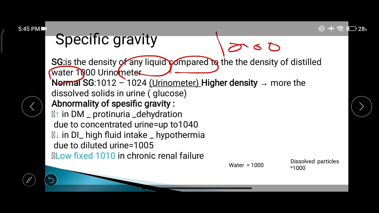 urine report (physical properties)