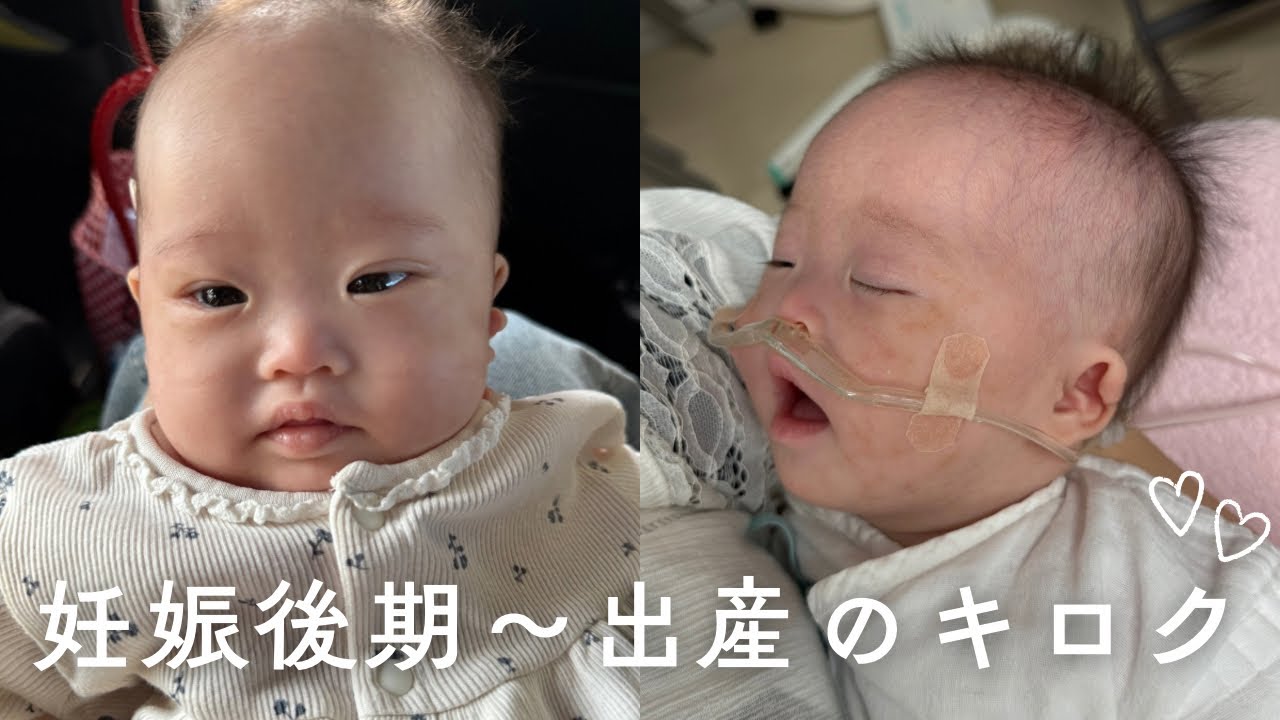 ダウン症がわかったきっかけ/羊水検査/エコー写真