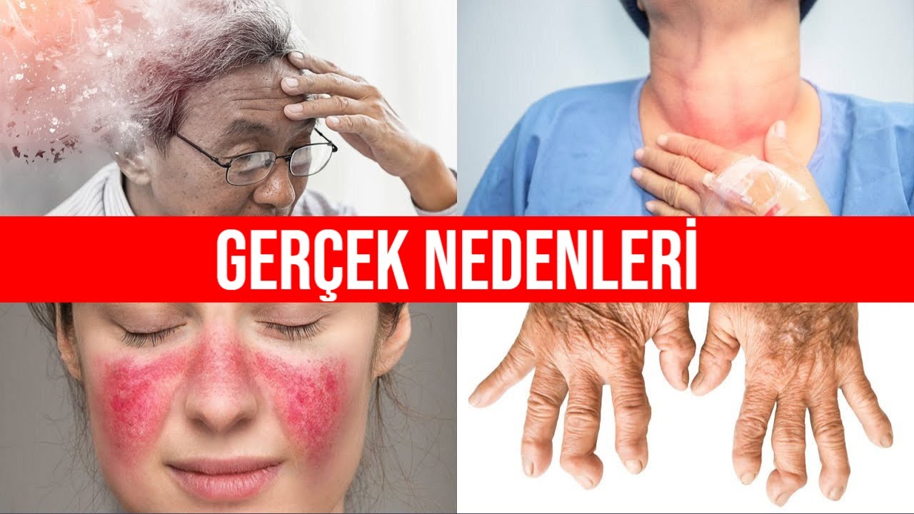 Tüm Otoimmün Hastalıkların Arkasındaki 1 Numaralı Eksiklik | Dr.Berg Türkçe