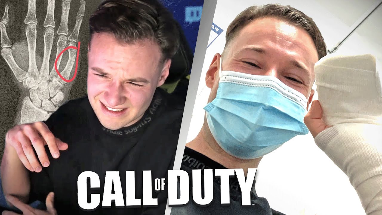 HAND GEBROCHEN DURCH COD