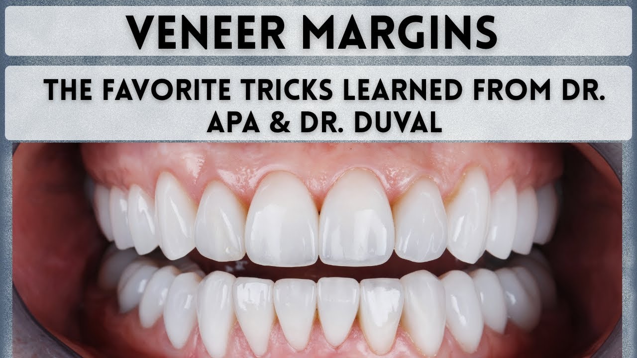 Veneer Margin Placement: How to Hide Margins & Keep Gums Healthy