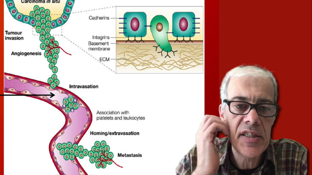 1.6 Metastasis and Angiogenesis