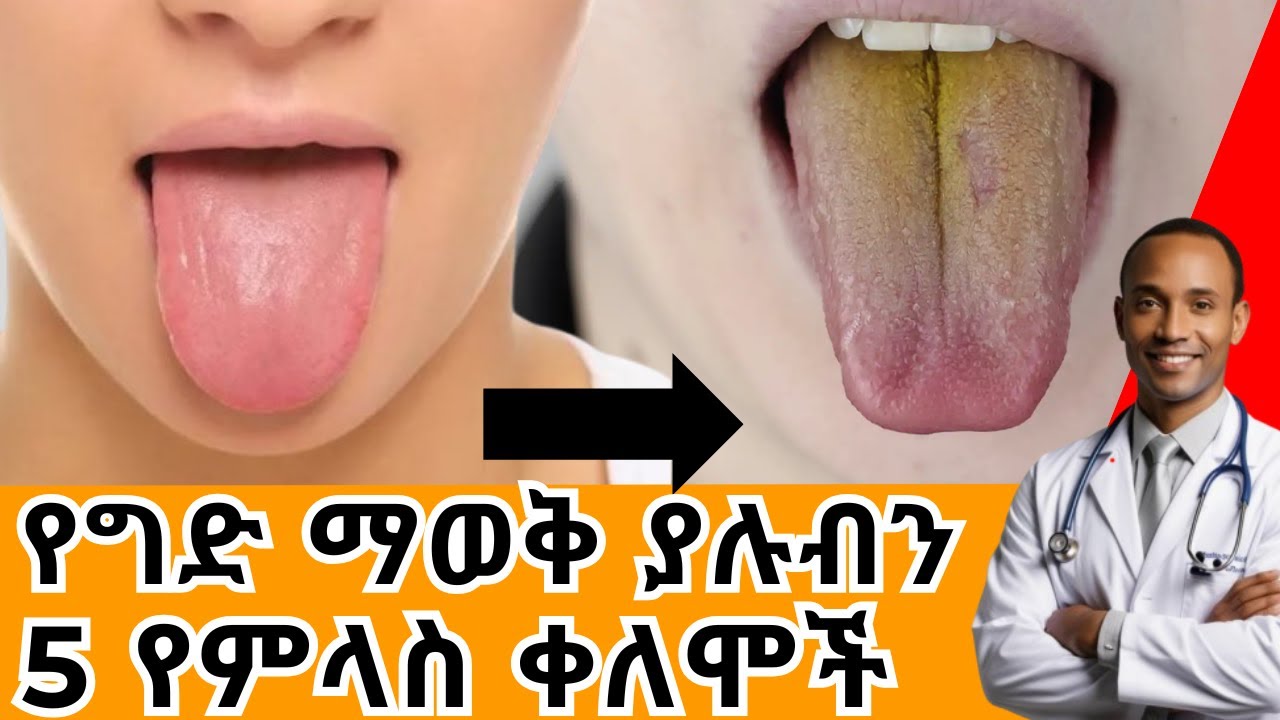 5ቱ የምላስ ቀለም አይነቶች እና የጤና ምልክቶቻቸው | Tongue color | Dr. Alem | ዶ/ር ዓለም #health #medical #education