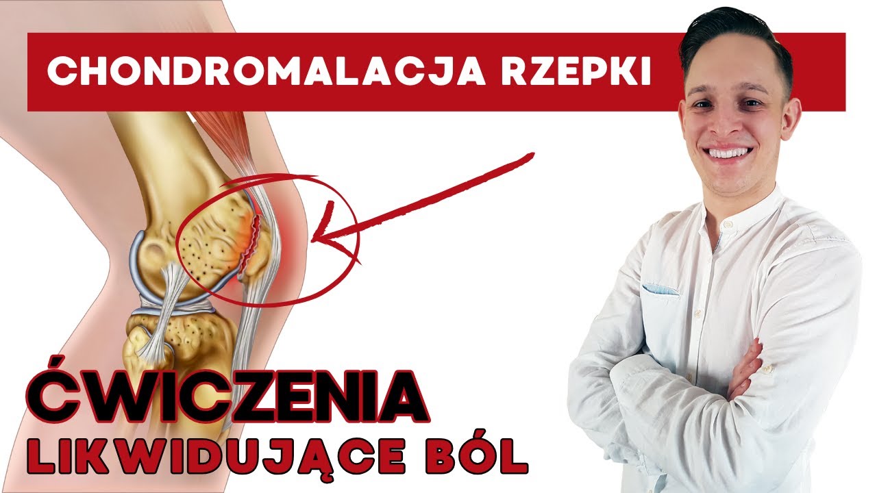 Chondromalacja rzepki ćwiczenia - 4 skuteczne sposoby na ból kolana