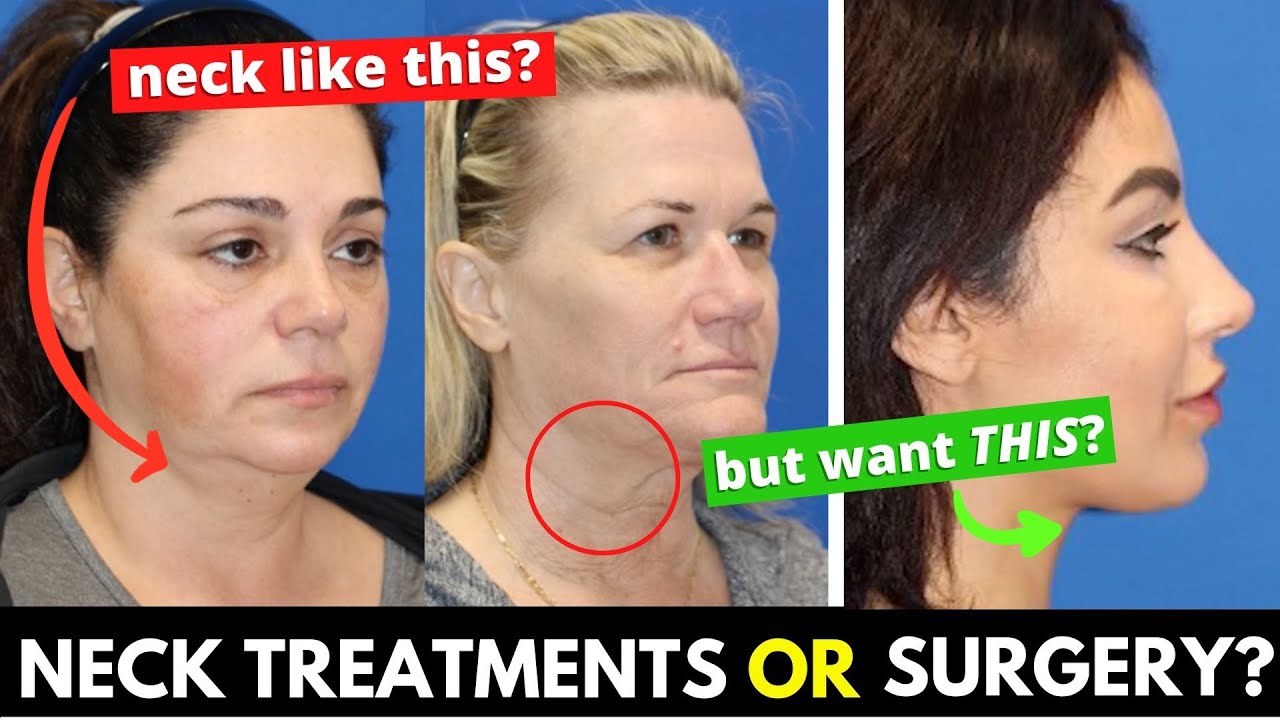 Are there any non-surgical neck treatments that ACTUALLY treat the aging neck?