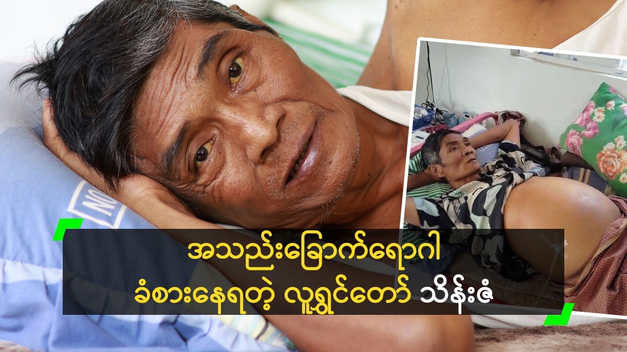 အသည်းခြောက်ရောဂါ ခံစားနေရတဲ့ လူရွှင်တော် သိန်းဇံ