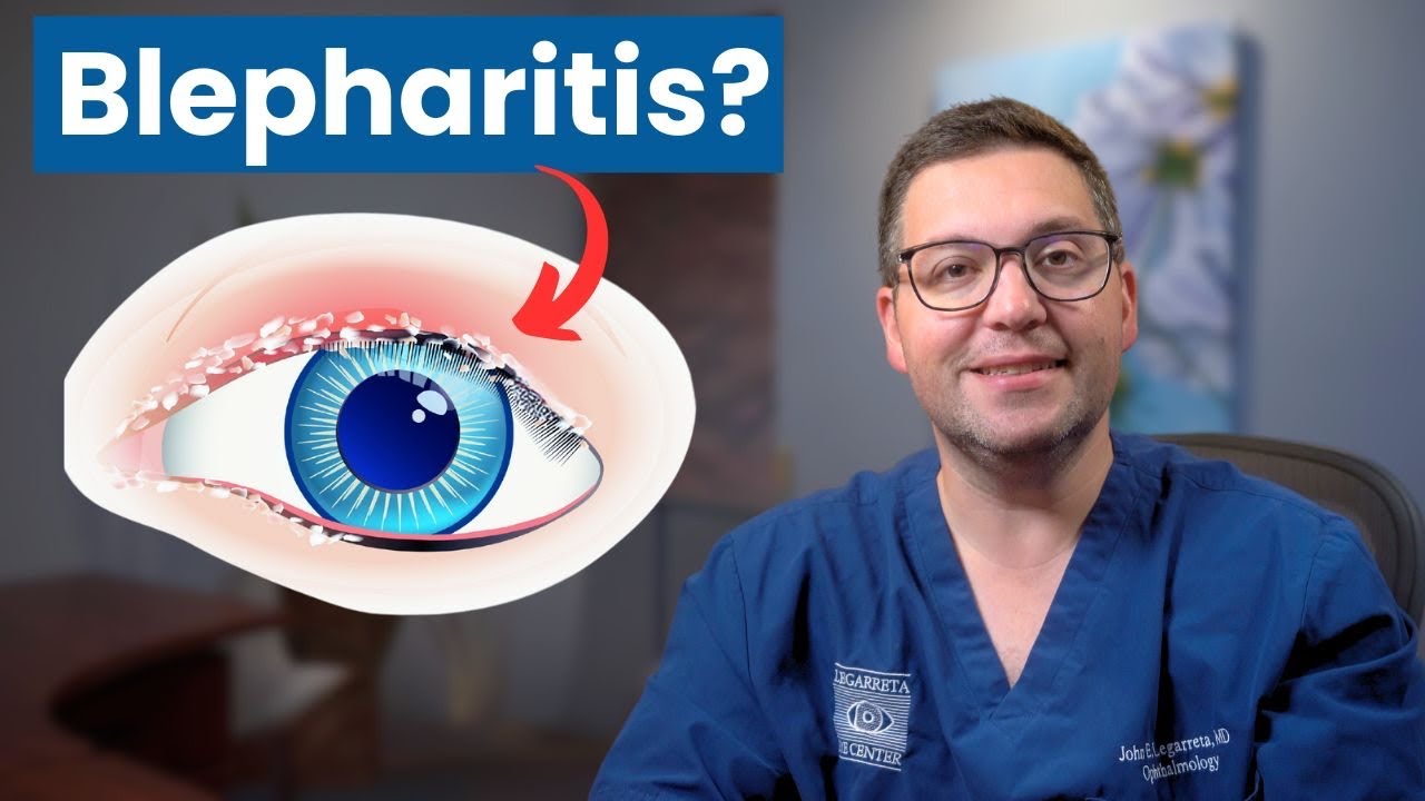 Easy Home Remedies for Blepharitis & MGD Relief