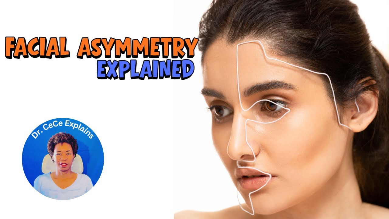 Facial Asymmetry Explained | Daily Habits Making Your Face Uneven & How To FIX It
