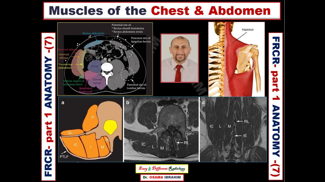 FRCR   part 1 Anatomy (lesson - 7) Chest & Abdomen muscle