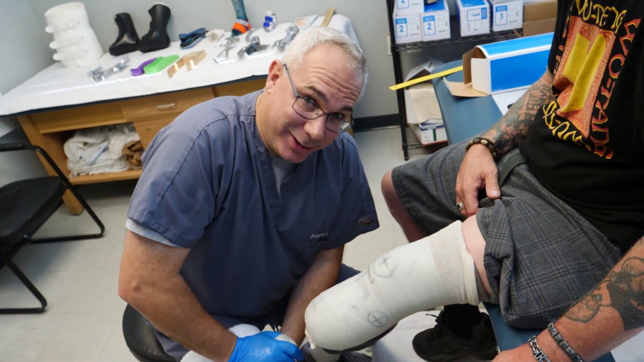How We Made An Artificial Leg: Start To Finish