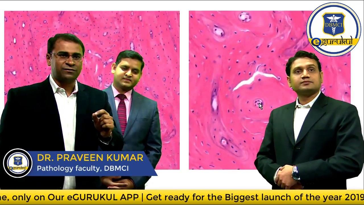 Radio-Patho_Ortho Integrated Discussion on BONE TUMOR