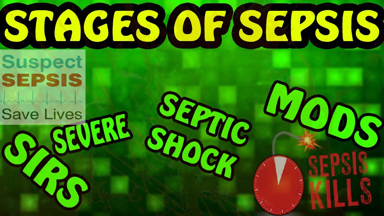 Stages of Sepsis (SIRS, Sepsis, Severe Sepsis, Septic Shock, MODS)
