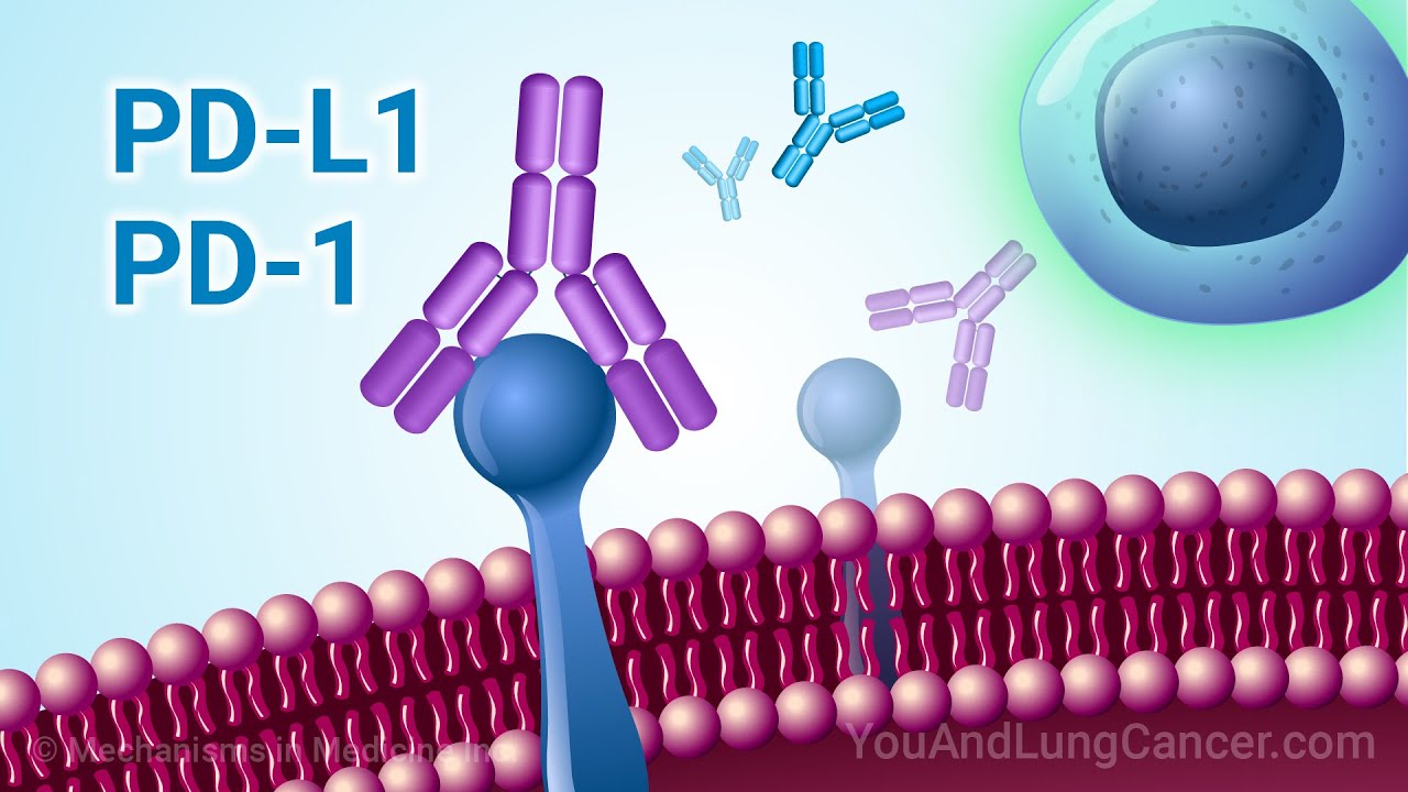 Понимание иммунотерапии НМРЛ с использованием биомаркеров PD-1 и PD-L1