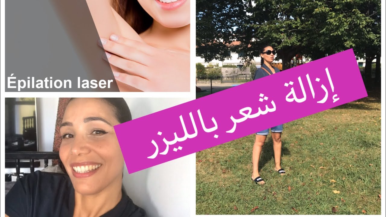 ازالة الشعر نهائيا  بالليزر /ازالة شعر كليا تجربتيl’épilation définitif