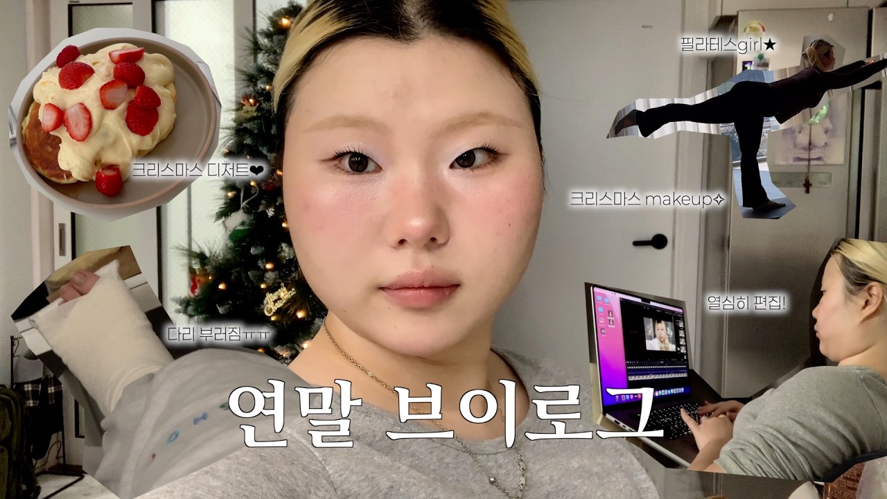 크리스마스 선물로 다리가 부러졌다....💔🩼