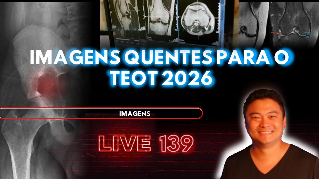 LIVE 139: IMAGENS QUENTES PARA O TEOT 2026- Sprint Ortopedia