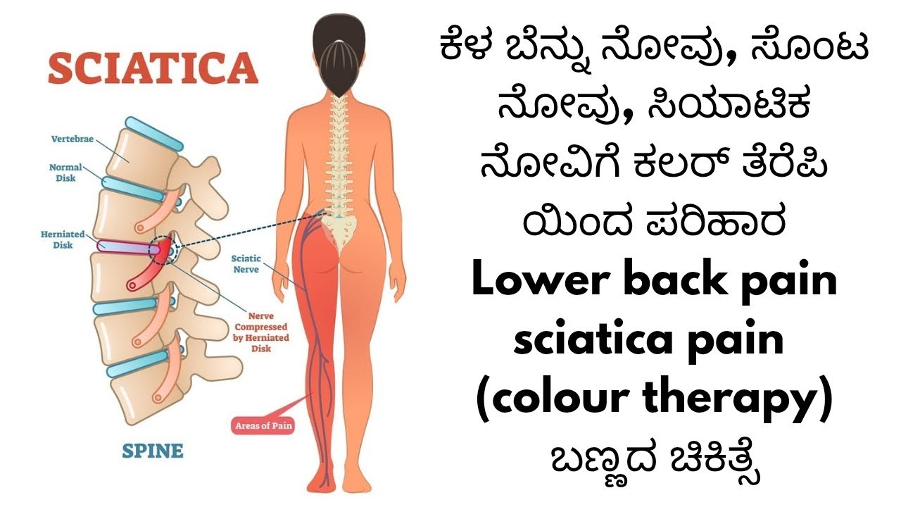 #yogastarmanigp #sciaticpain #ಸೊಂಟನೋವು #colotherapy #ಬಣ್ಣದ ಚಿಕಿತ್ಸೆ