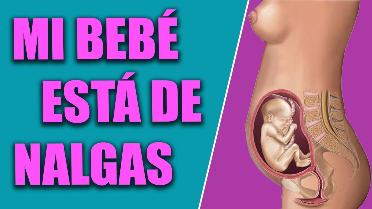 MI BEBE ESTÁ DE NALGAS | Cómo ayudar a girar al bebé a posición CEFÁLICA 🤷‍♀️🤰