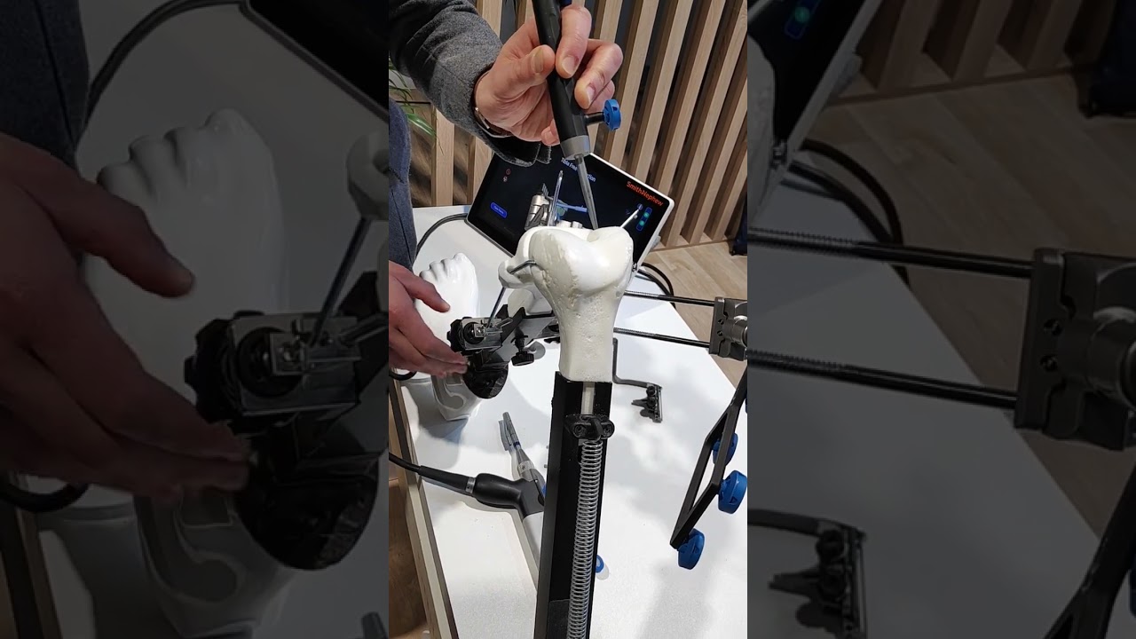 L'innovation de la robotique dans la chirurgie orthopédique