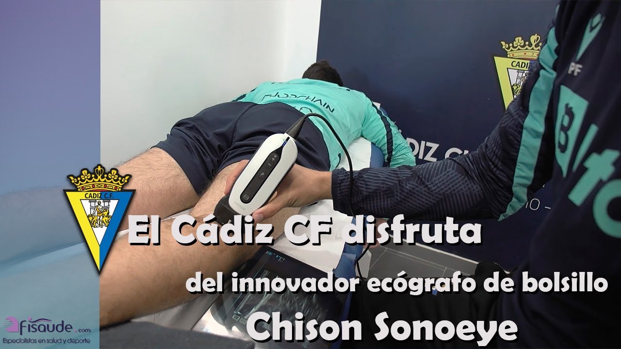El Cádiz CF disfruta del innovador ecógrafo portátil Sonoeye  | Resultados sorprendentes