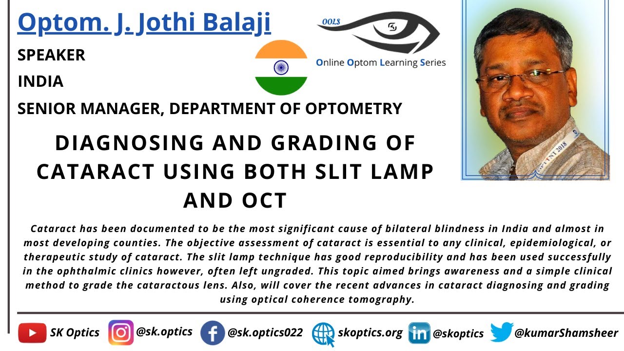 Diagnosing and Grading of #Cataract using both Slit Lamp and OCT. | OOLS | Optom. J. Jothi Balaji