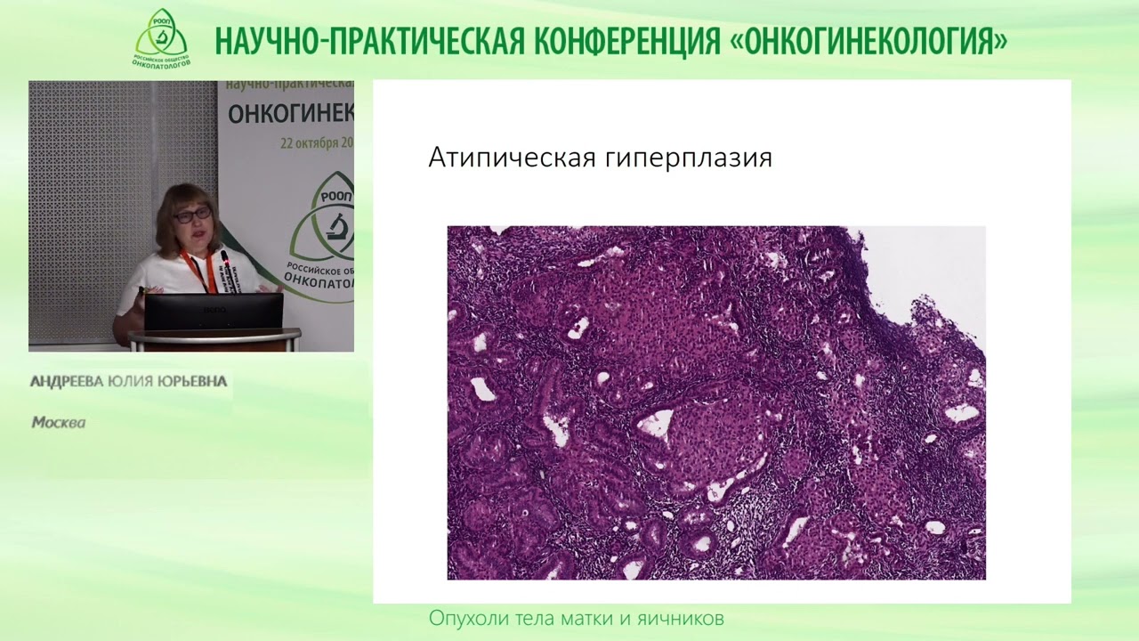 Атипическая гиперплазия и рак эндометрия  Диагностика и лечение