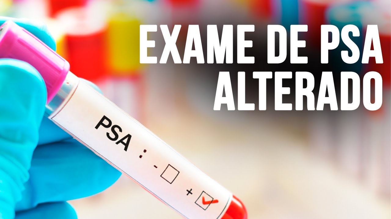 EXAME DE PSA ALTERADO - CRESCIMENTO DA PR&Oacute;STATA - Dr. Andr&eacute; de Matos Urologista