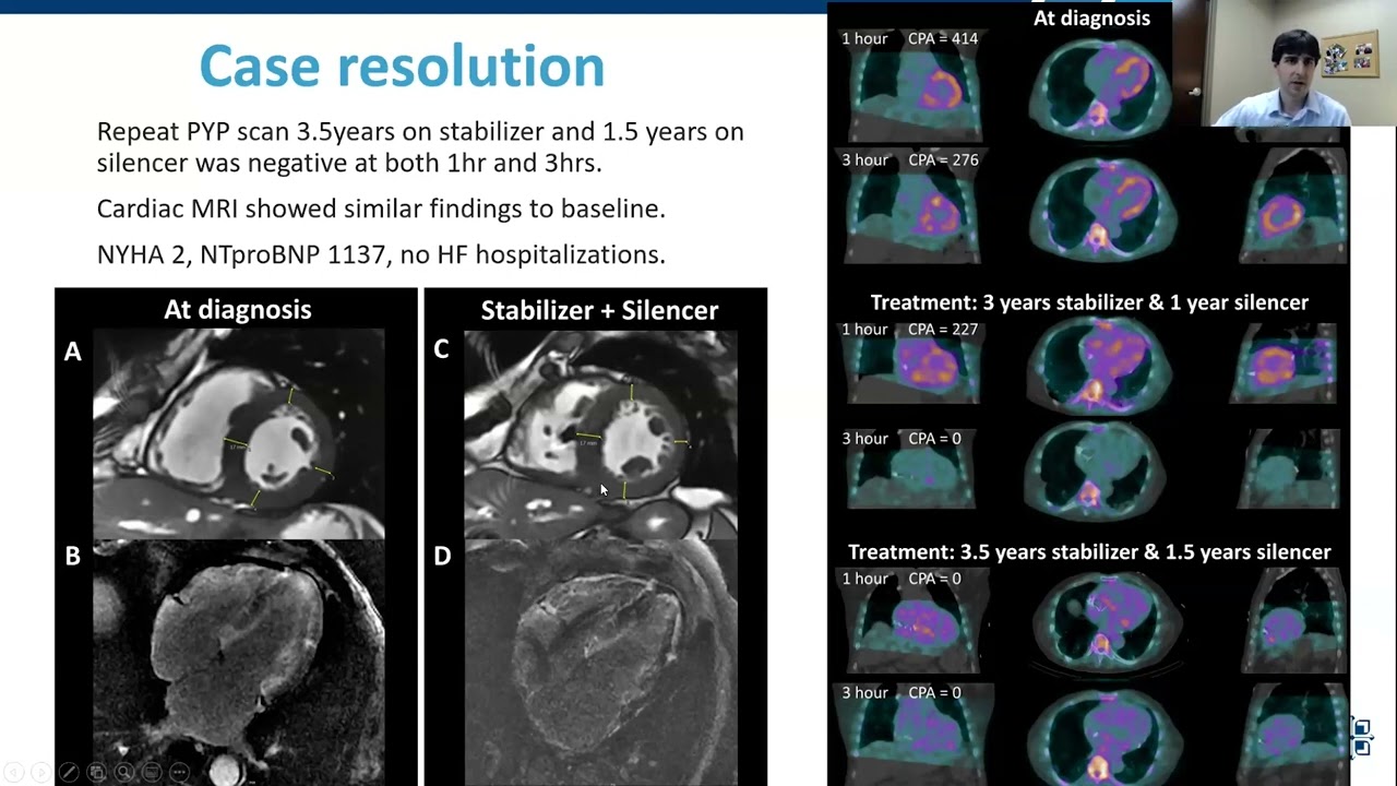 The Diagnostic Effectiveness of Nuclear, Molecular and Multimodality Imaging Techniques, 5/11/2023
