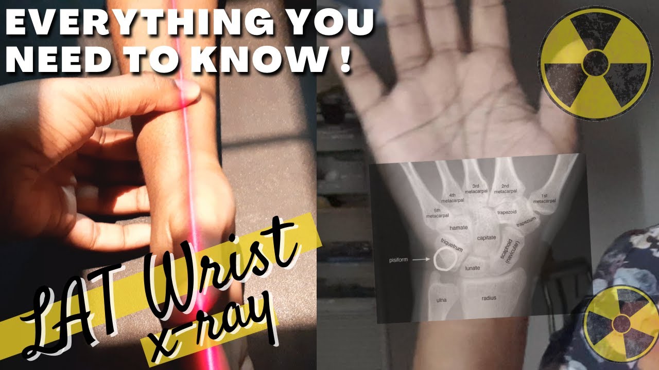 how to: LATERAL WRIST X-RAY positioning tips || Ask The Rad Tech