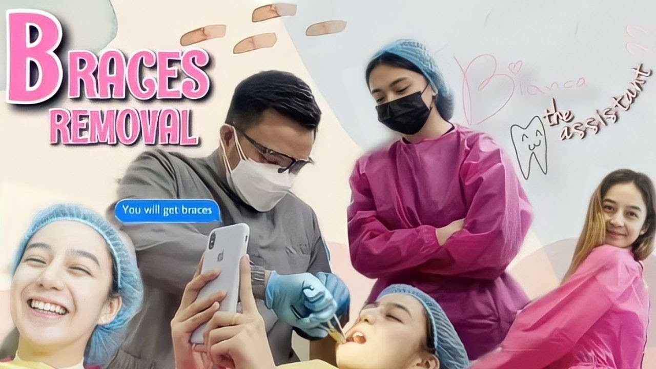 Braces Removal | Fatima Añonuevo