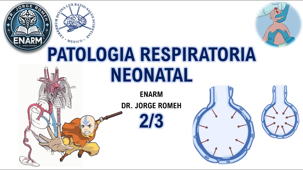 SINDROME DE DIFICULTAD RESPIRATORIA (MEMBRANA HIALINA) - 2/3 - ENARM - TODO LO QUE DEBES SABER