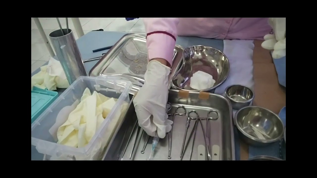 Video Pemasangan Implant Tugas Mata kuliah Pelayanan Kontrasepsi 