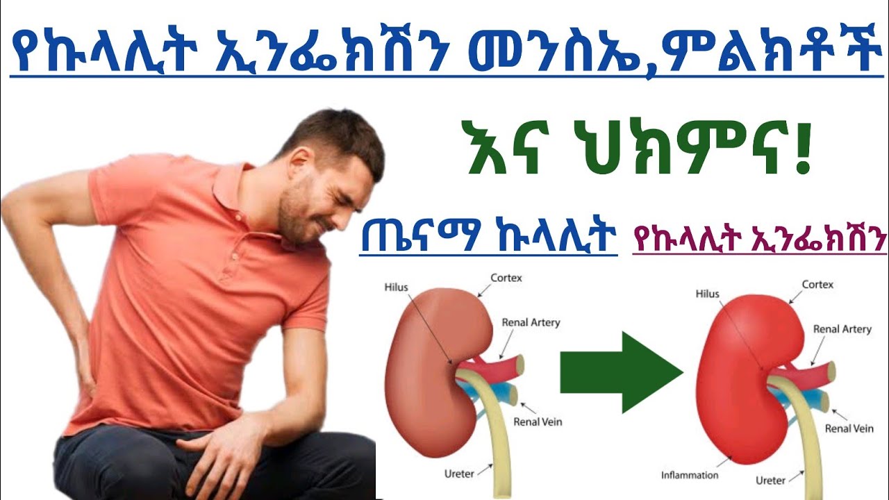 የኩላሊት ኢንፌክሽን የሚከሰትበት መንስኤ,ምልክቶች,የሚያስከትለው ጉዳት ና ህክምና| sign,Causes and treatments of kidney infection