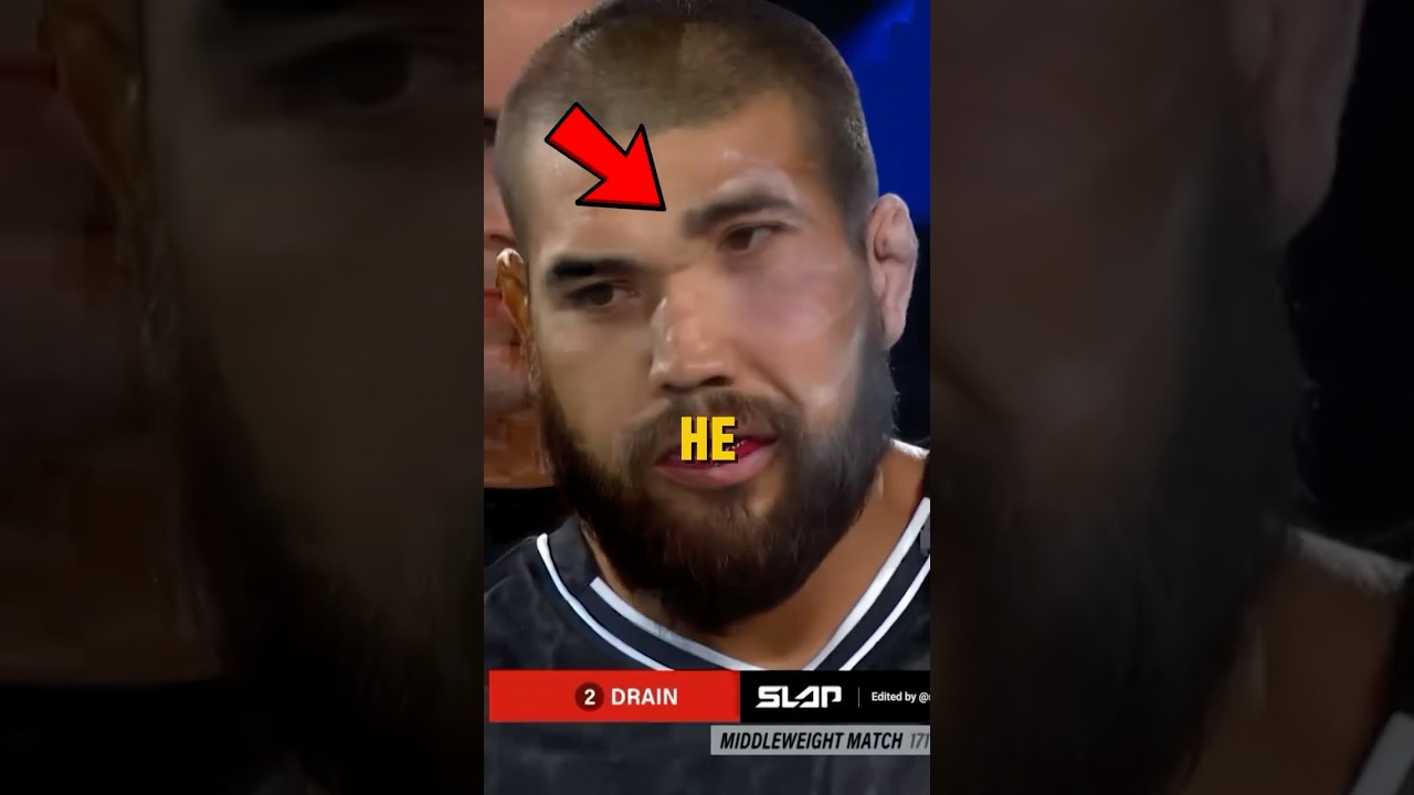Slapped Deformed his Face😨 (@skrr_da)