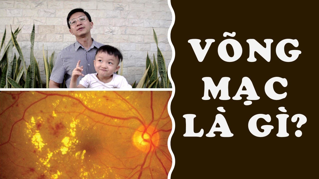 Vlog #18 - Tìm hiểu về Võng mạc và Dịch kính (Pha lê thể) - BS. Nguyễn Như Quân