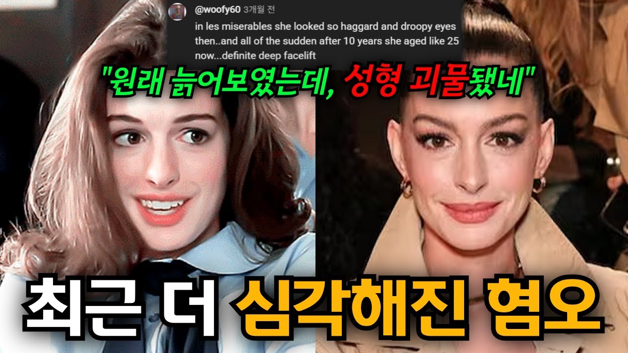 완벽한 여배우의 저주... 앤 헤서웨이에 대한 혐오가 선을 넘은 진짜 이유