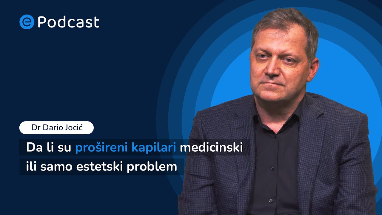 ePodcast - Da li su prošireni kapilari medicinski ili samo estetski problem - Dr Dario Jocić