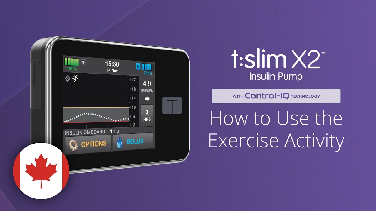 How to Use the Exercise Activity Feature on the t:slim X2 Insulin Pump with Control-IQ Technology