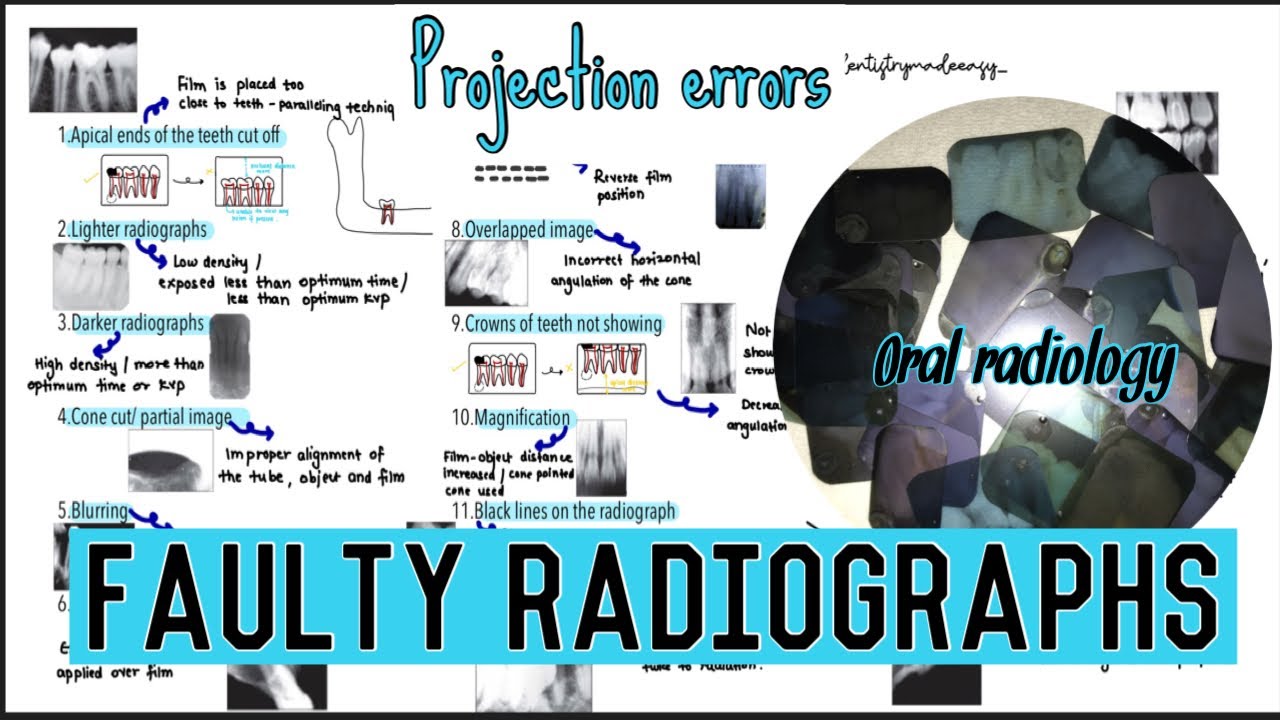 FAULTY RADIOGRAPHS || PROJECTION ERRORS || ORAL RADIOLOGY || Part 1