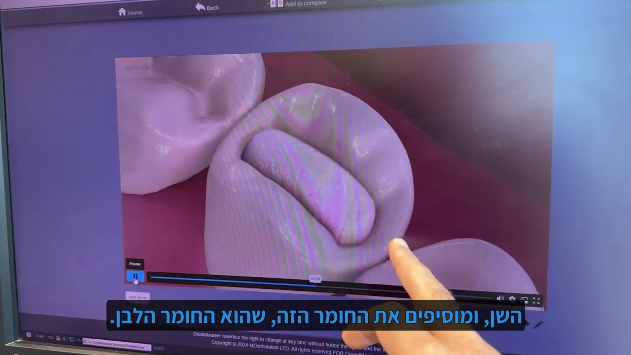 ככה עושים סתימה לבנה
