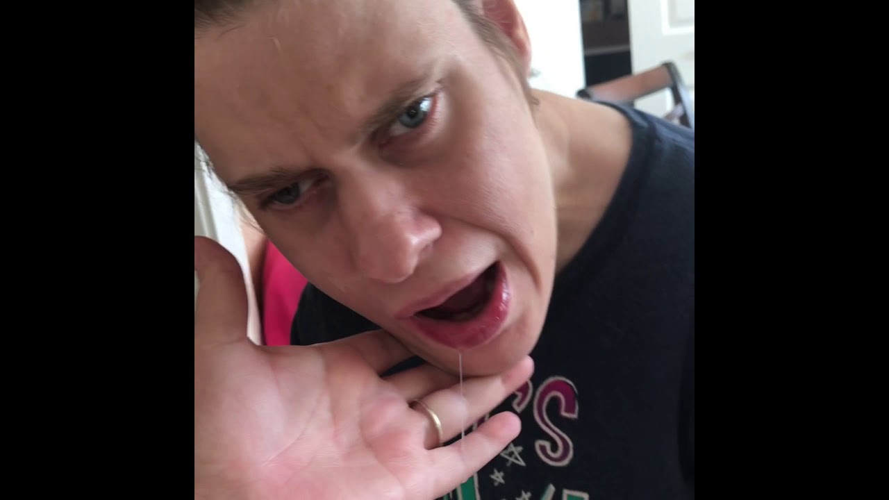Life With Cerebral Palsy | Meningitis | Epilepsy