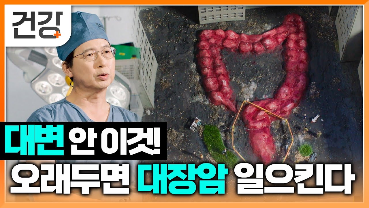대변 안의 발암물질 오래 정체될수록 대장암, 직장암 발병률 높인다? | 변비가 무서운 이유 | 명의 | EBS 건강